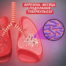 В Україні 2024–2026 роки є ключовим етапом реалізації державної стратегії протидії туберкульозу (ТБ)