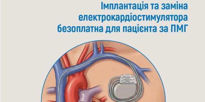 Продовжуємо роз’яснення для пацієнтів про зміни в кардіохірургії у 2026 році