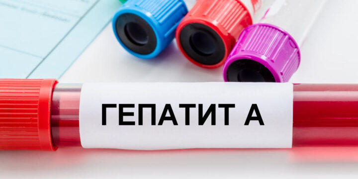 ВІРУСНИЙ ГЕПАТИТ A