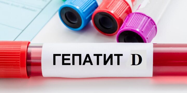ВІРУСНИЙ ГЕПАТИТ D